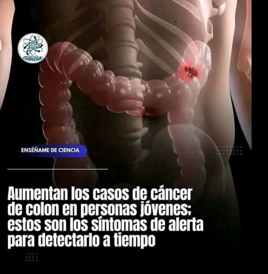 Síntomas de Cáncer de Colon