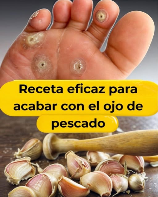 Remedio Casero para Ojo de Pescado