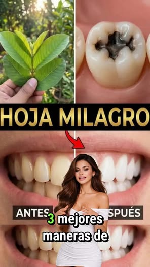 3 Maneras Caseras con Hojas de Guayaba para una Boca Más Fuerte