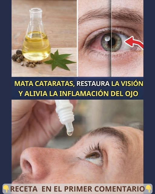 Remedios Naturales para Aliviar los Ojos Secos y Mejorar la Salud Ocular